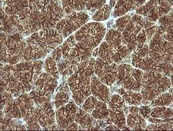 Beta-catenin Monoclonal Antibody (OTI9C1), TrueMAB , OriGene:Antibodies:Primary