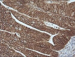 Beta-catenin Monoclonal Antibody (OTI9C1), TrueMAB , OriGene 100 &mu;L;