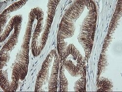 Beta-catenin Monoclonal Antibody (OTI9C1), TrueMAB , OriGene 100 &mu;L;