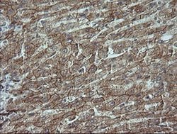 Beta-catenin Monoclonal Antibody (OTI9C1), TrueMAB , OriGene 100 &mu;L;