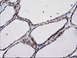 Beta-catenin Monoclonal Antibody (OTI9F6), TrueMAB , OriGene 30 &mu;L;