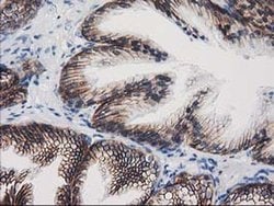 Beta-catenin Monoclonal Antibody (OTI9F6), TrueMAB , OriGene 30 &mu;L;