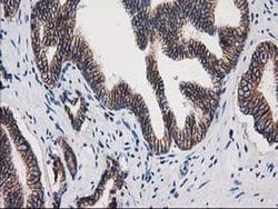 Beta-catenin Monoclonal Antibody (OTI9F6), TrueMAB , OriGene 30 &mu;L;