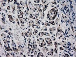 Beta-catenin Monoclonal Antibody (OTI9F6), TrueMAB , OriGene 30 &mu;L;