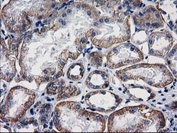 Beta-catenin Monoclonal Antibody (OTI9F6), TrueMAB , OriGene:Antibodies:Primary