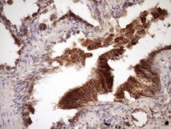 Beta-catenin Monoclonal Antibody (OTI2F10), TrueMAB , OriGene 100 &mu;L;