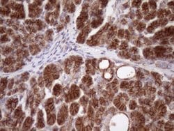 Beta-catenin Monoclonal Antibody (OTI2F10), TrueMAB , OriGene 100 &mu;L;