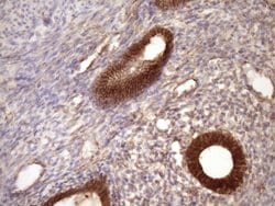 Beta-catenin Monoclonal Antibody (OTI2F10), TrueMAB , OriGene 100 &mu;L;