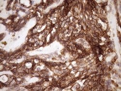 Beta-catenin Monoclonal Antibody (OTI2F10), TrueMAB , OriGene 100 &mu;L;