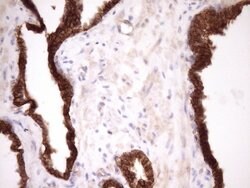 Beta-catenin Monoclonal Antibody (OTI2F10), TrueMAB , OriGene 100 &mu;L;