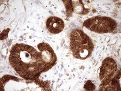 Beta-catenin Monoclonal Antibody (OTI2F10), TrueMAB , OriGene 100 &mu;L;