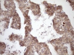Beta-catenin Monoclonal Antibody (OTI2F10), TrueMAB , OriGene 100 &mu;L;