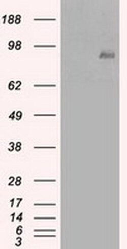 Beta-catenin Mouse anti-Human, Clone: OTI3G4, liquid, TrueMAB 100 &mu;L;
