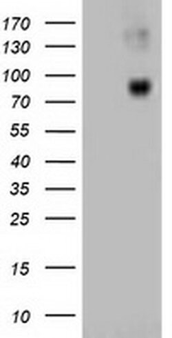 Beta-catenin Monoclonal Antibody (OTI1G1), TrueMAB , OriGene 100 &mu;L;