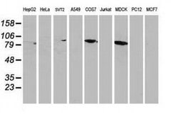 Beta-catenin Monoclonal Antibody (OTI1G1), TrueMAB , OriGene 100 &mu;L;