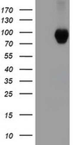 Beta-catenin Mouse anti-Human, Mouse, Clone: OTI1H10, liquid, TrueMAB 100