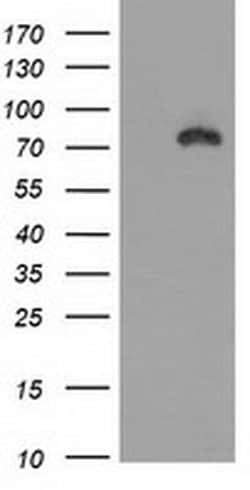 Beta-catenin Monoclonal Antibody (OTI2F6), TrueMAB , OriGene:Antibodies:Primary
