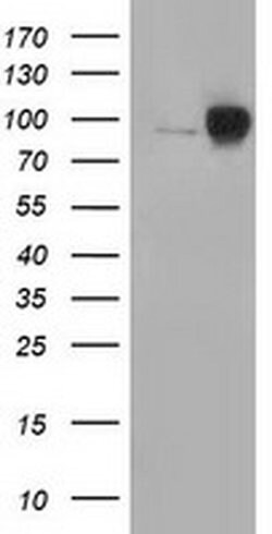 Beta-catenin Monoclonal Antibody (OTI5D2), TrueMAB , OriGene 30 &mu;L;