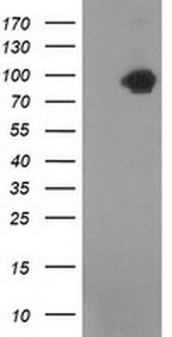 Beta-catenin Monoclonal Antibody (OTI1E10), TrueMAB , OriGene 100 &mu;L;