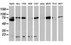 Beta-catenin Monoclonal Antibody (OTI1E10), TrueMAB , OriGene 100 &mu;L;