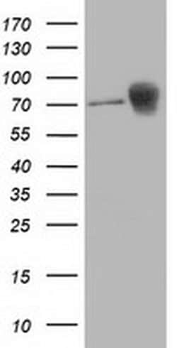 Beta-catenin Monoclonal Antibody (OTI8B5), TrueMAB , OriGene 100 &mu;L;