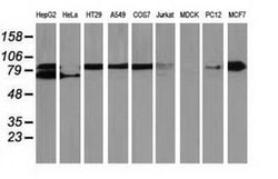 Beta-catenin Monoclonal Antibody (OTI8B5), TrueMAB , OriGene 100 &mu;L;