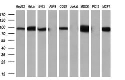 Beta-catenin Monoclonal Antibody (OTI1B11), TrueMAB , OriGene 30 &mu;L;