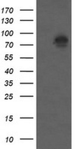 Beta-catenin Monoclonal Antibody (OTI9C1), TrueMAB , OriGene 100 &mu;L;