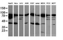 Beta-catenin Monoclonal Antibody (OTI9C1), TrueMAB , OriGene 100 &mu;L;
