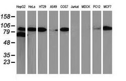 Beta-catenin Mouse anti-Human, Rat, Clone: OTI12H7, lyophilized, TrueMAB