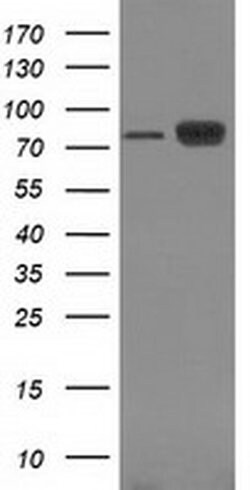 Beta-catenin Monoclonal Antibody (OTI9F6), TrueMAB , OriGene:Antibodies:Primary