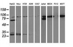 Beta-catenin Monoclonal Antibody (OTI9F6), TrueMAB , OriGene 30 &mu;L;