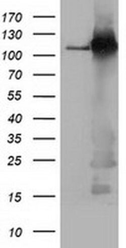 BuB1B Mouse anti-Canine, Human, Rat, Clone: OTI6E3, liquid, TrueMAB 100