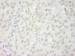 BubR1 Polyclonal Antibody, Bethyl Laboratories:Antibodies:Primary Antibodies