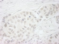 BubR1 Polyclonal Antibody, Bethyl Laboratories 100 &mu;L; Unconjugated:Antibodies,