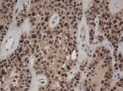 C-Jun Mouse anti-Canine, Human, Mouse, Rat, Clone: OTI2D11, lyophilized,