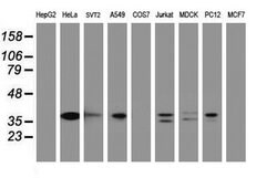 C-Jun Mouse anti-Canine, Human, Mouse, Rat, Clone: OTI2D11, lyophilized,