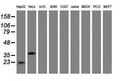 C-Jun Mouse anti-Human, Clone: OTI9F5, lyophilized, TrueMAB 100 &mu;g;