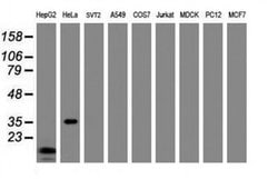 C-Jun Monoclonal Antibody (OTI2E11), TrueMAB , OriGene:Antibodies:Primary