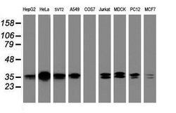 C-Jun Mouse anti-Canine, Human, Mouse, Rat, Clone: OTI2A4, lyophilized,