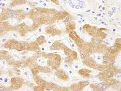 Human C-Reactive Protein (CRP) Polyclonal Antibody, Bethyl Laboratories