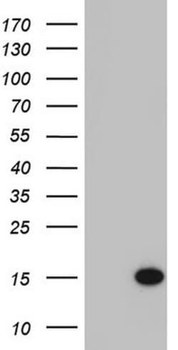 C11orf67 Monoclonal Antibody (OTI1C4), TrueMAB , OriGene 100 &mu;L; Unconjugated:Antibodies,