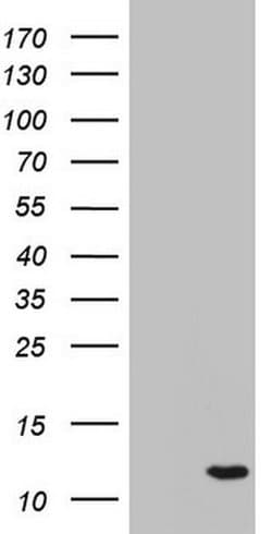 C11orf67 Monoclonal Antibody (OTI4C1), TrueMAB , OriGene 100 &mu;L; Unconjugated:Antibodies,