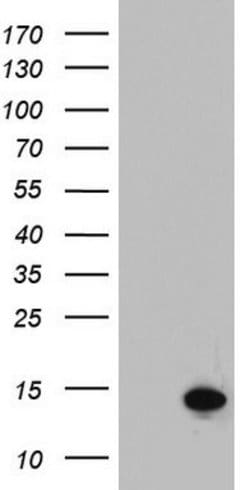 C11orf67 Mouse anti-Human, Clone: OTI5E4, lyophilized, TrueMAB 100 &mu;g;