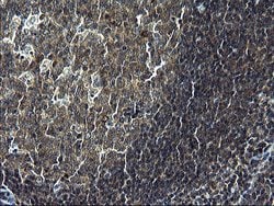 C12orf26 Monoclonal Antibody (OTI2B6), TrueMAB , OriGene:Antibodies:Primary
