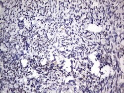 C14orf166 Monoclonal Antibody (OTI2A4), TrueMAB , OriGene 100 &mu;L; Unconjugated:Antibodies,