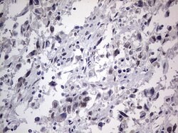 C14orf166 Monoclonal Antibody (OTI2A4), TrueMAB , OriGene 100 &mu;L; Unconjugated:Antibodies,