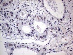 C14orf166 Monoclonal Antibody (OTI2A4), TrueMAB , OriGene 100 &mu;L; Unconjugated:Antibodies,