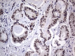 C14orf166 Monoclonal Antibody (OTI2A4), TrueMAB , OriGene 100 &mu;L; Unconjugated:Antibodies,