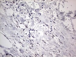 C14orf166 Monoclonal Antibody (OTI2A4), TrueMAB , OriGene 100 &mu;L; Unconjugated:Antibodies,